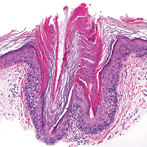 histo-1