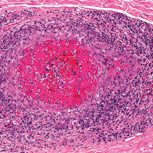 histo-2