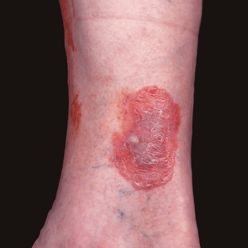 histo-3